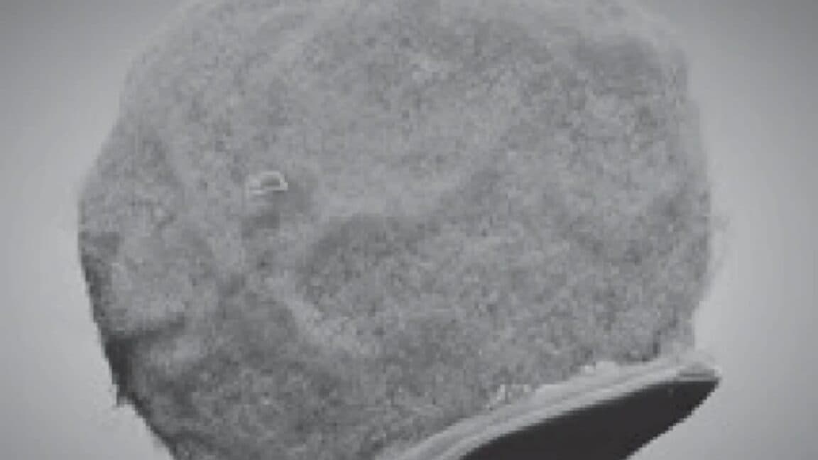 "Immune squad rolling up with tiny chips to fight inflammation like it’s a meme war 💪🔥 #Bussin"