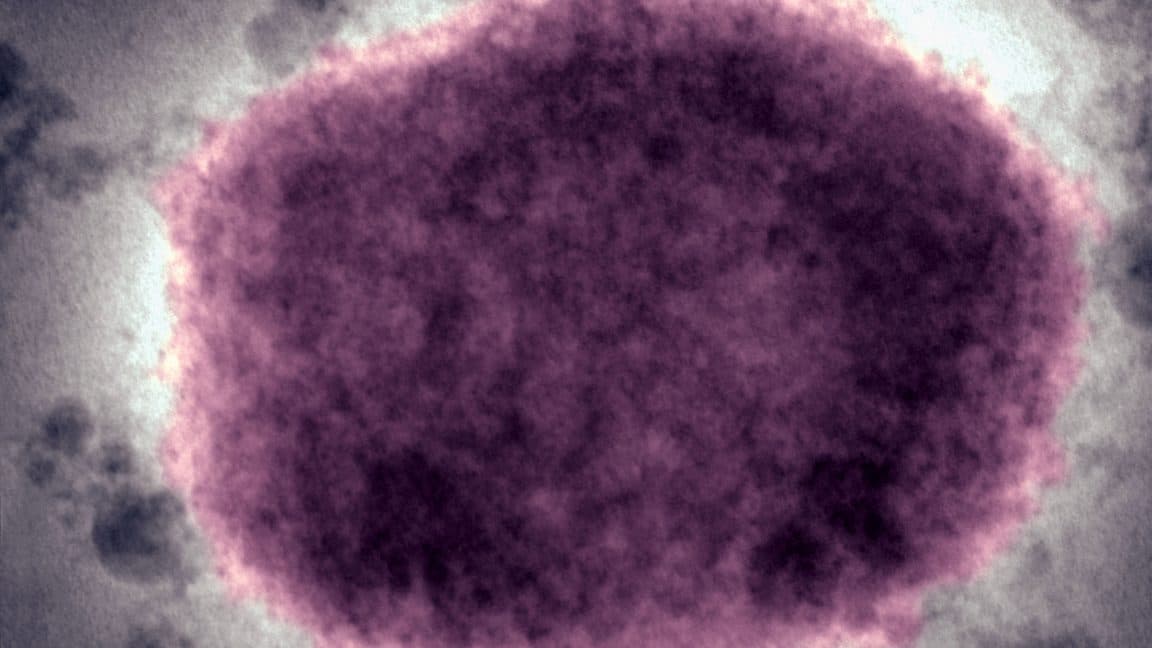 "US going back to cringe disease names like it’s 2016 😭💀 Can we not? #RacismReloaded"