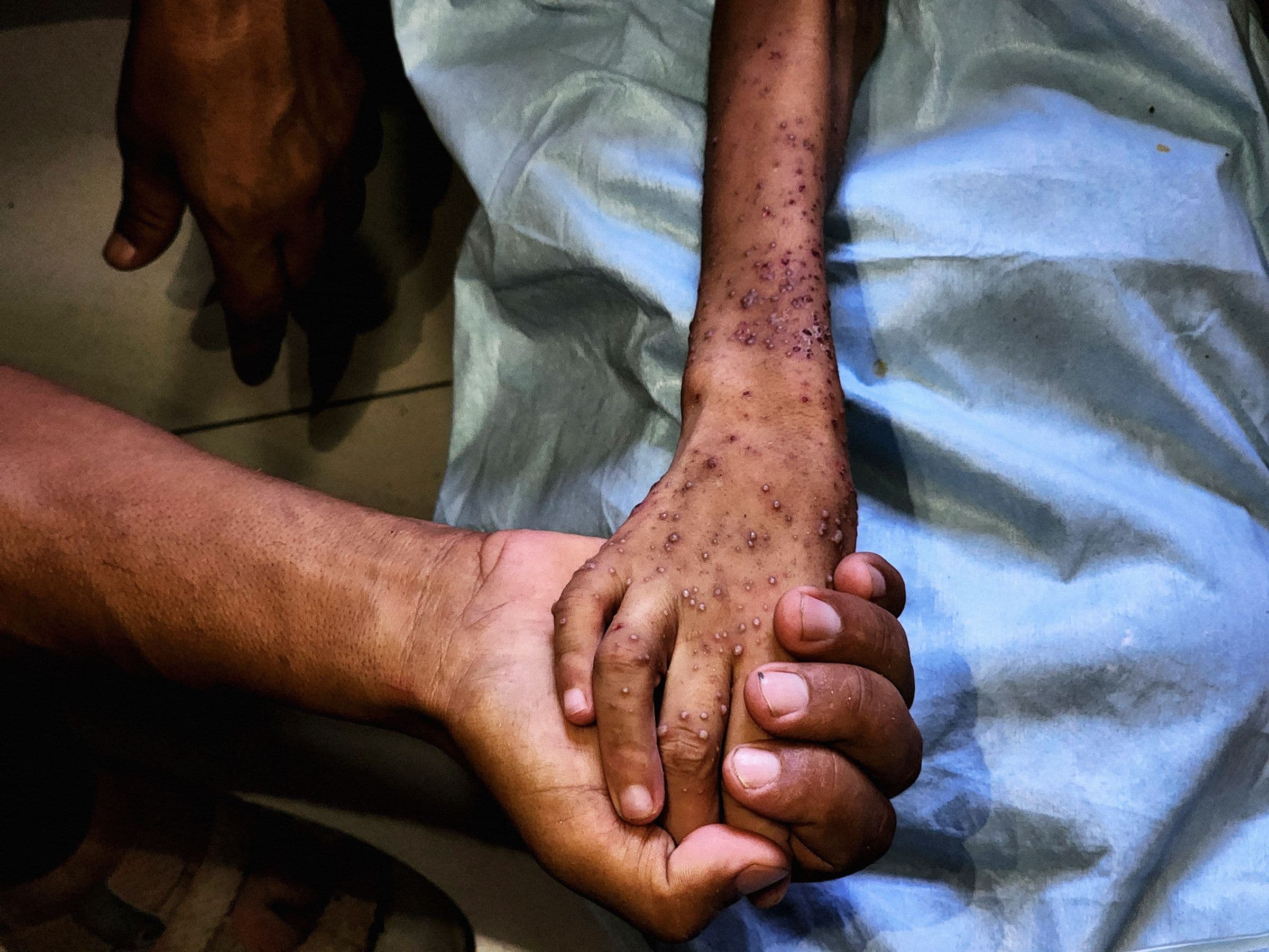 "Bro, Gaza's malnutrition got us all 404'ing health 😱💀 & the lag is REAL. Send help! 🚨 #NotCool"