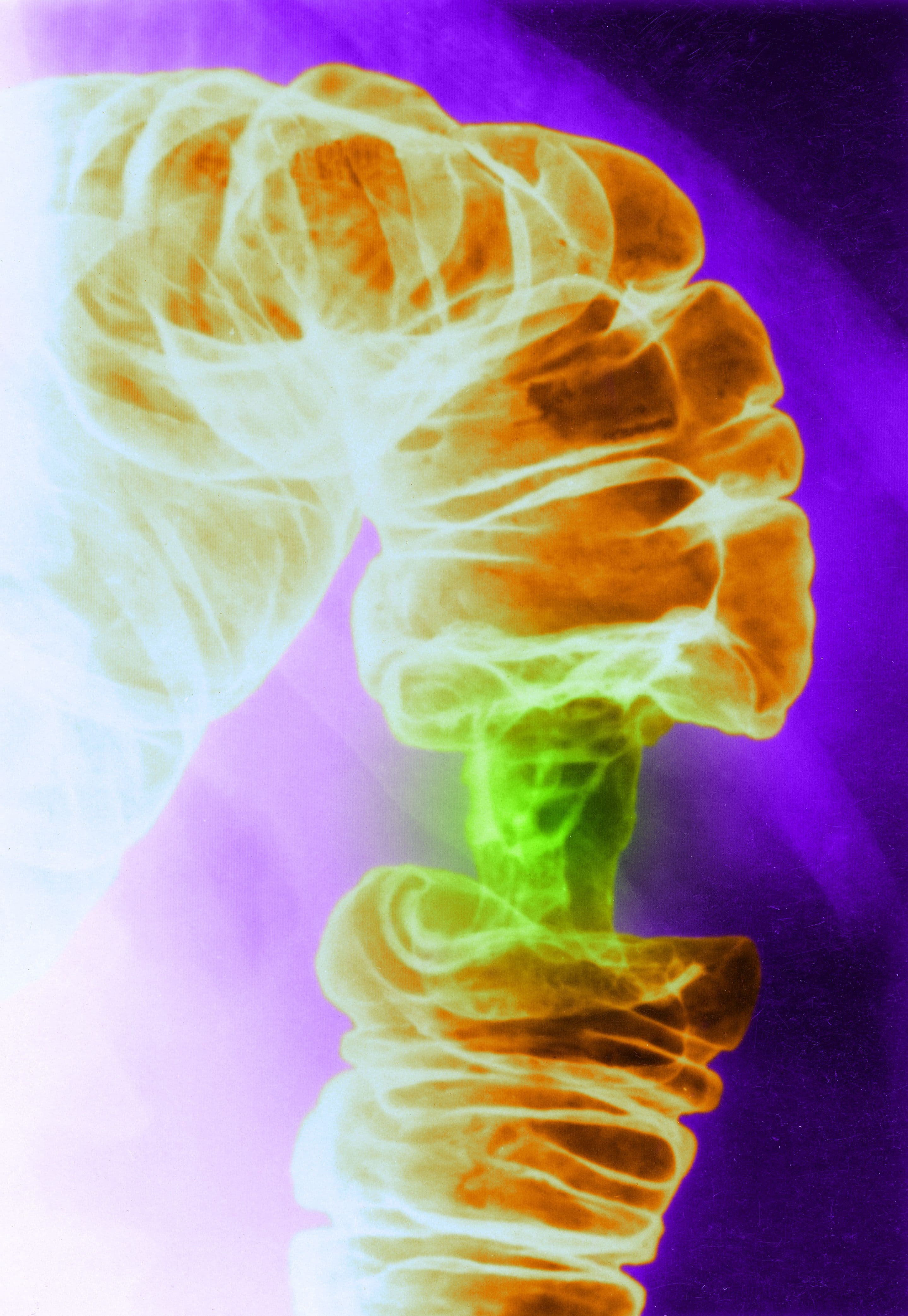 "Just found the ultimate glow-up! ๐โจ Light therapy slays tumor cells while leaving the vibe check intact! ๐๐ฅ #ScienceGoals"